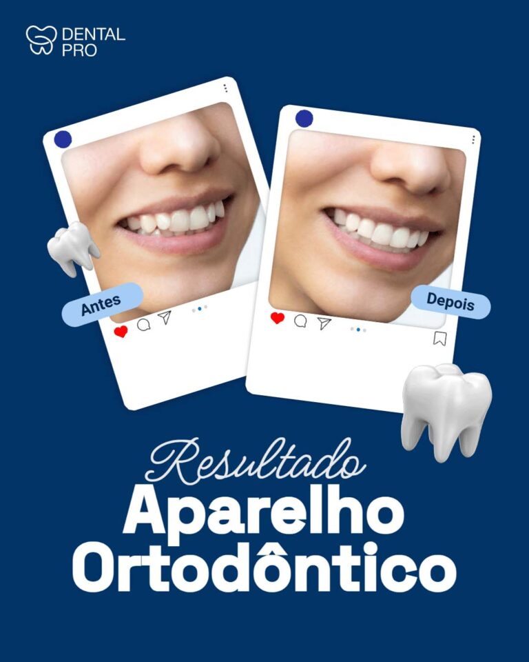 Antes e depois 1(2)