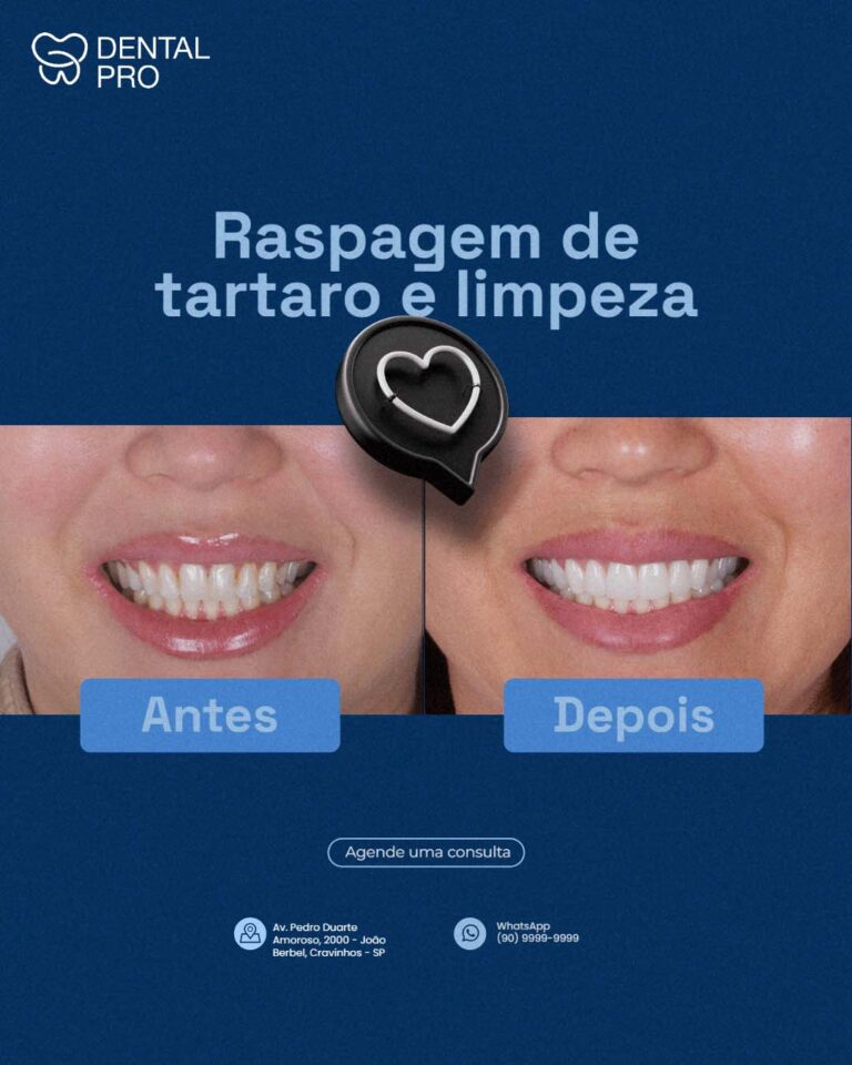 Antes e depois 2(2)