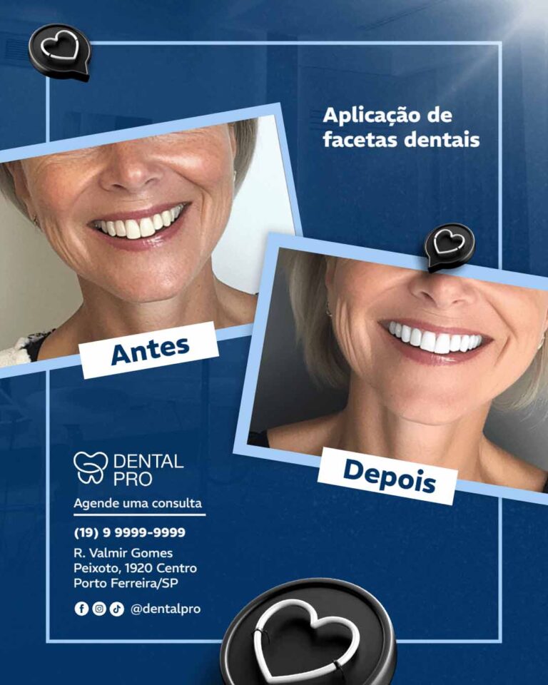 Antes e depois 3(2)