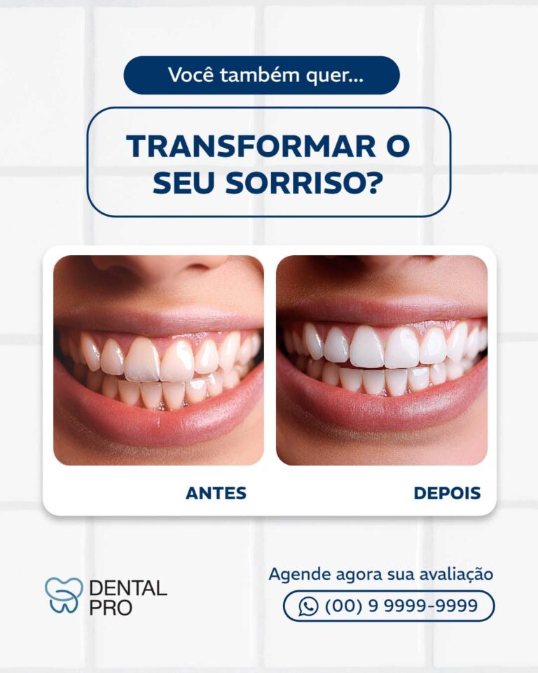 Antes e depois 4(2)