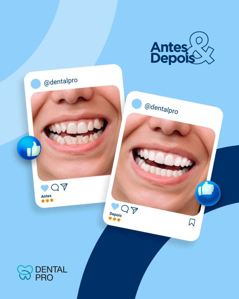Antes e depois 5(2)
